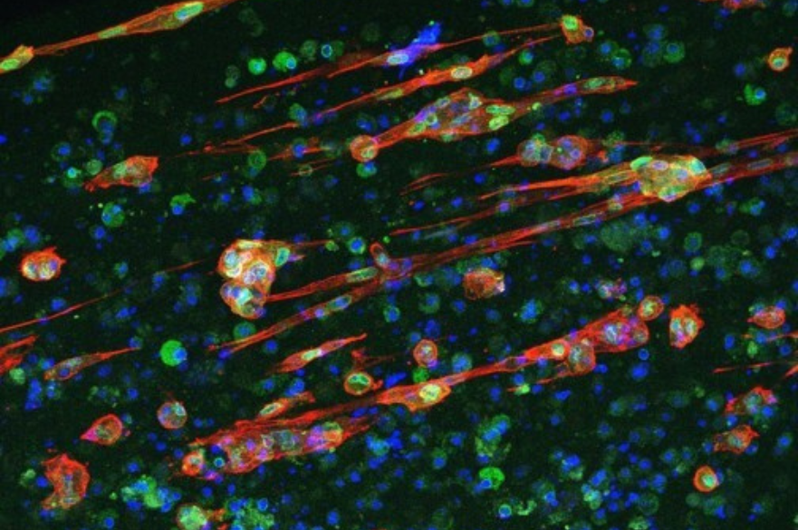 3. Francesca Tomlinson Skeletal Muscle Cells
